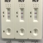 HCV